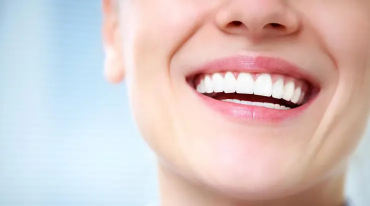 Advantages and disadvantages of teeth whitening